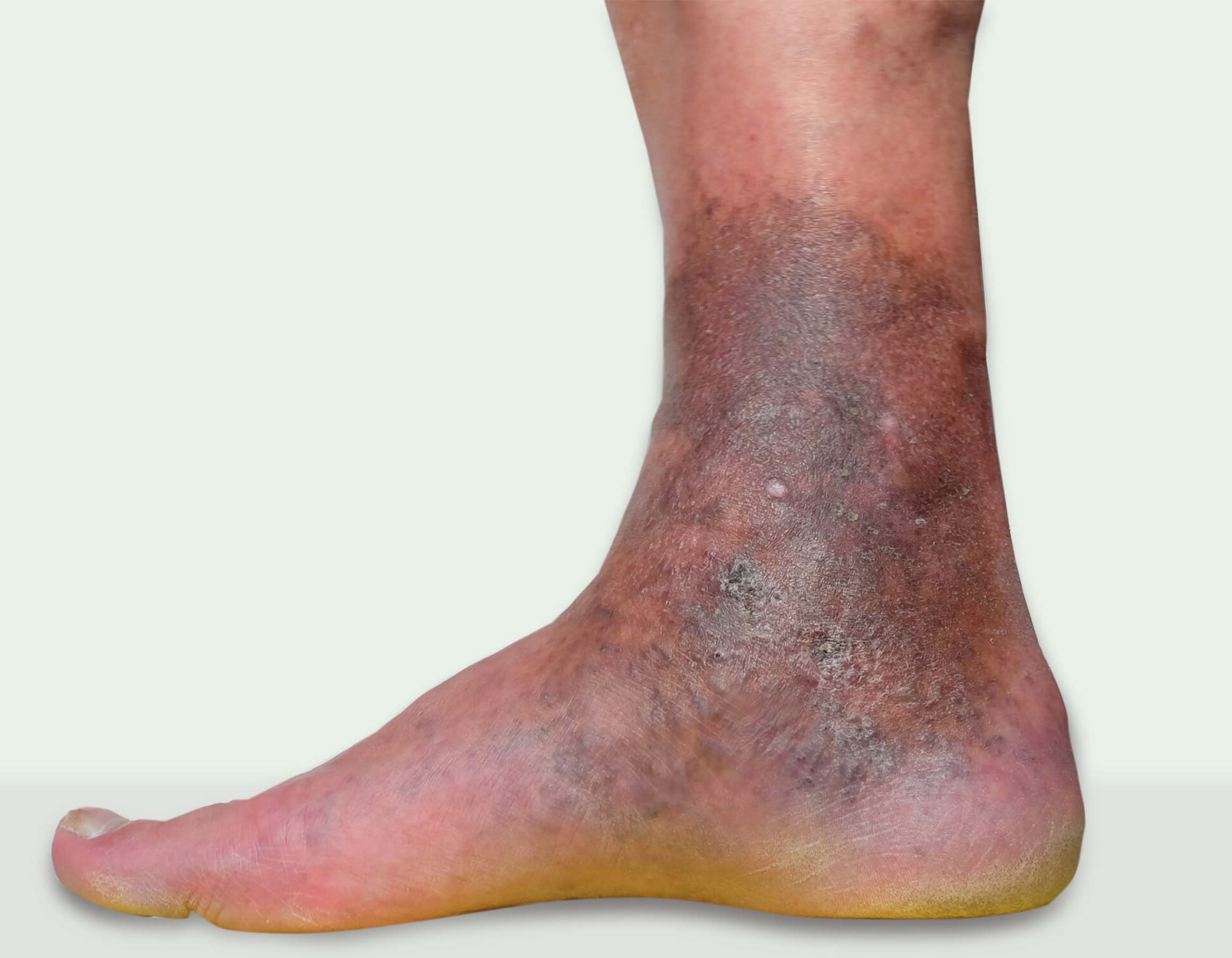 Doppler Ultrasound Diagnosis